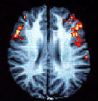 "fMRI Brain Scan Thomas Ramsoy"